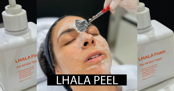 lhala-peel-em-sp